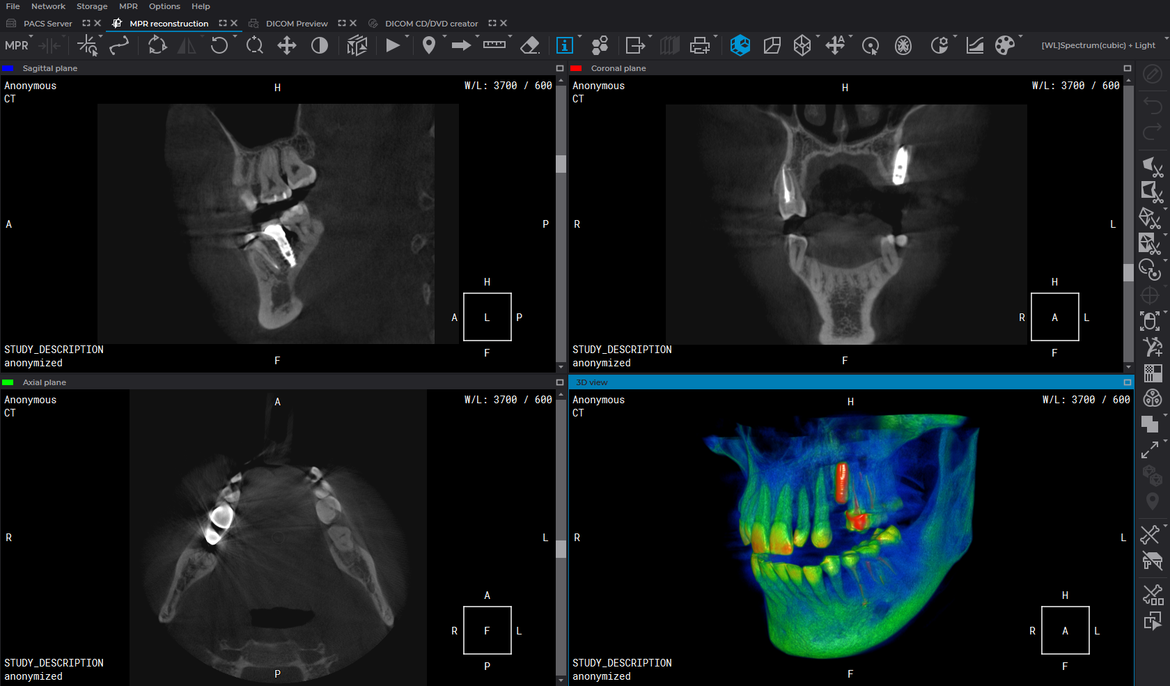 inobitec viewer lite photo