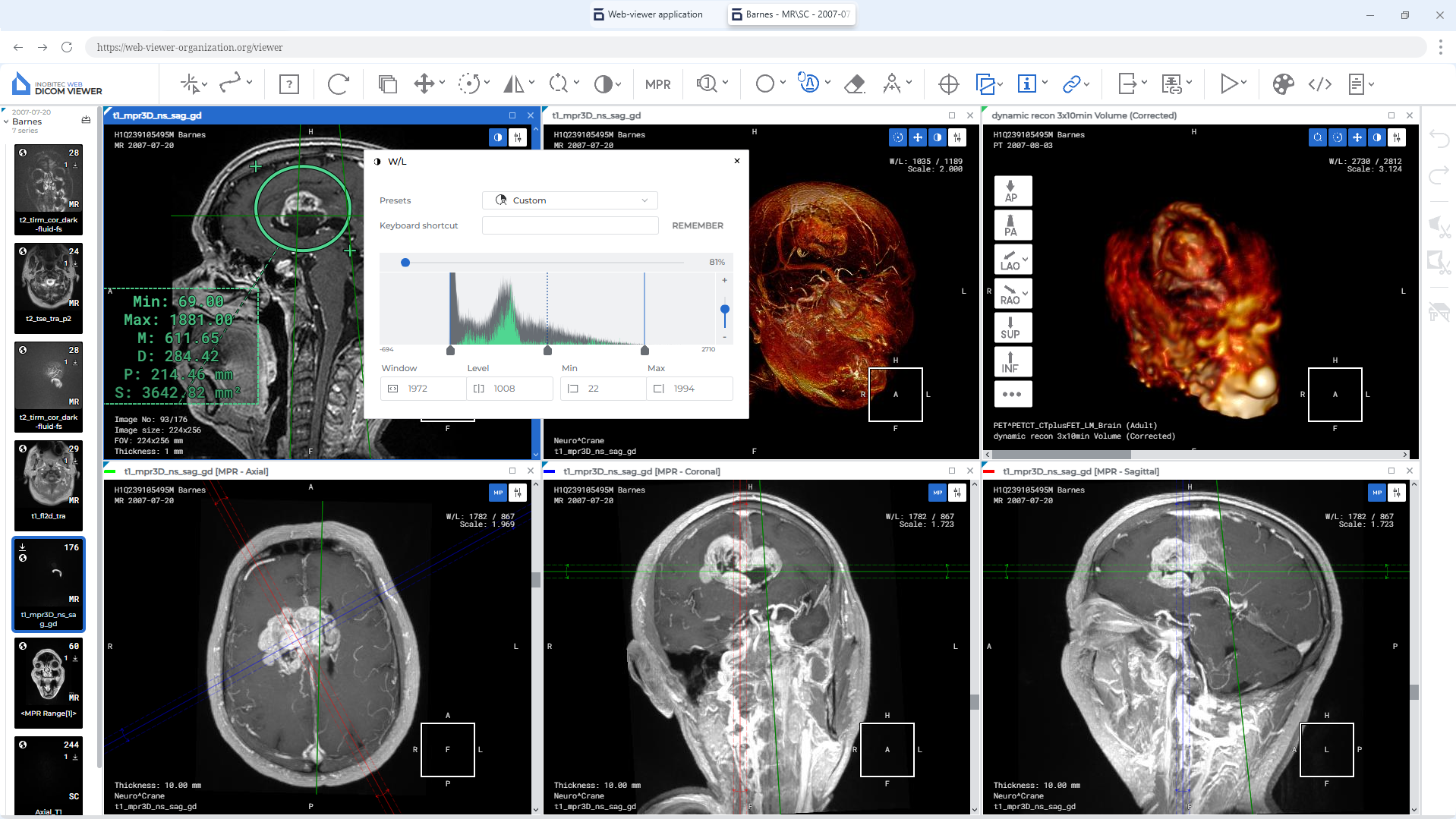 inobitec viewer lite photo